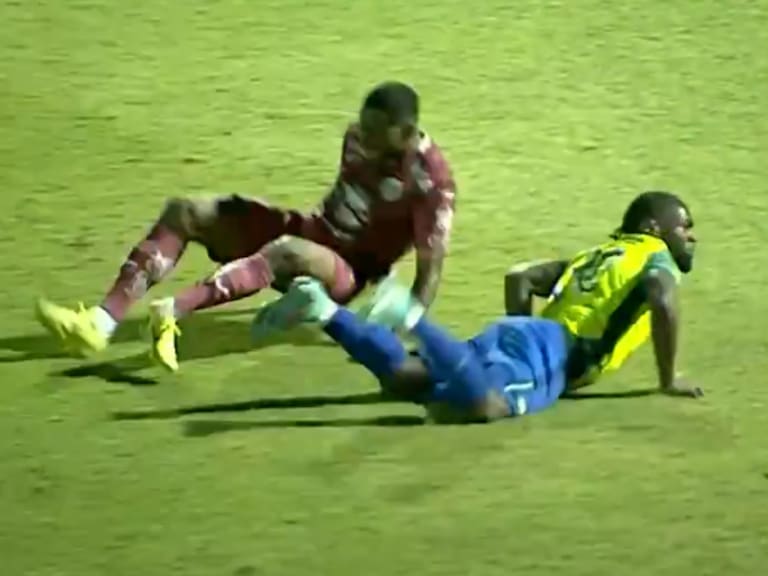Romario Da Silva, del Motagua, sufre escalofriante fractura en la Liga Nacional de Honduras 2026