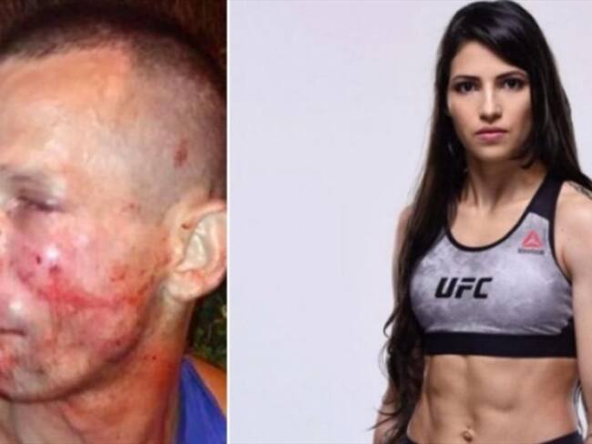 Peleadora de UFC golpea a asaltante