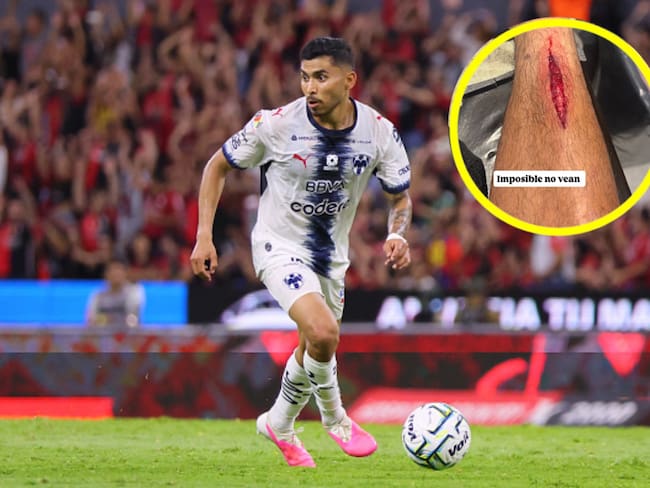 La terrible herida de Orbelín Pineda tras entrada de roja en el Atlas vs Rayados
