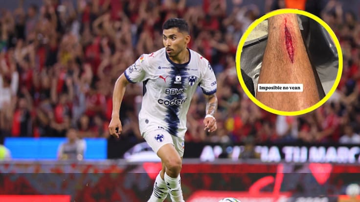 La terrible herida de Orbelín Pineda tras entrada de roja en el Atlas vs Rayados