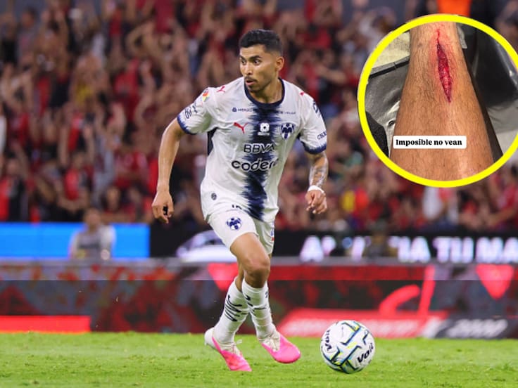 La terrible herida de Orbelín Pineda tras entrada de roja en el Atlas vs Rayados