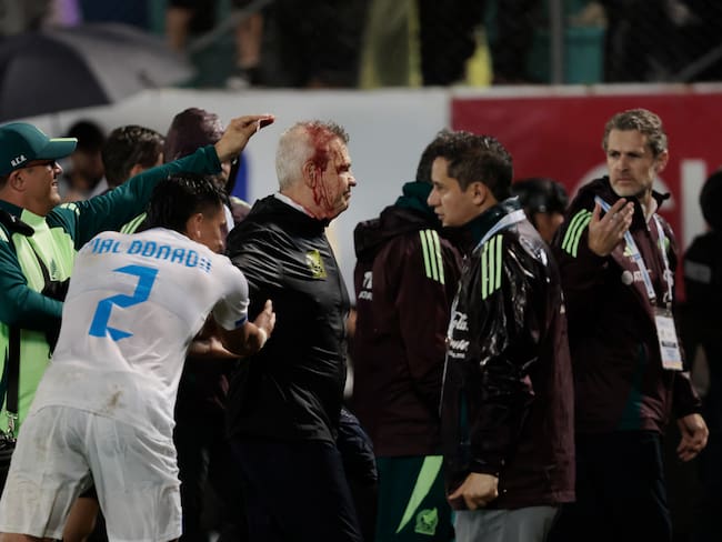 Javier Aguirre sufrió un corte en la cabeza y terminó ensangrentado en San Pedro Sula; ¡Inaceptable!