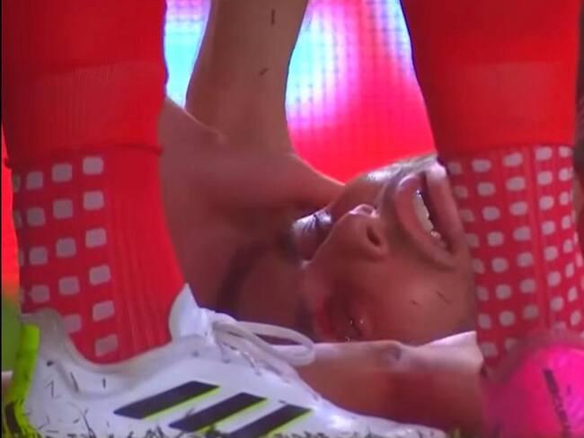 Así quedó el ojo de Alejandro Mayorga tras el golpe de Richard Sánchez