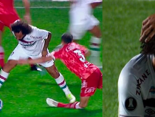 Luciano Sánchez: Fractura espeluznante del jugador de Argentinos Juniors